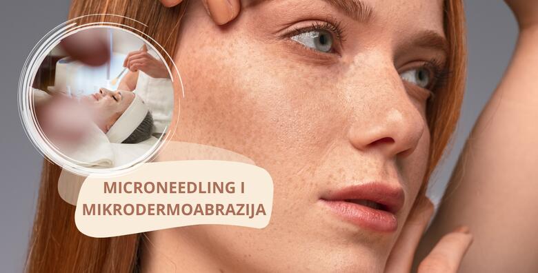 POPUST: 54% - Smanjite mrlje, bore i ožiljke uz MICRONEEDLING i MIKRODERMOABRAZIJU za blistavu kožu, ujednačeniji ten i regeneraciju u Re-age centru (Re-age Centar)