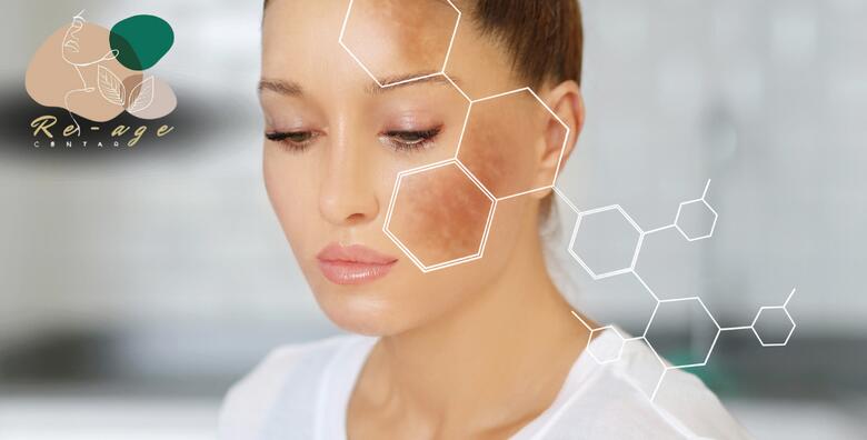 Želite se rješiti tamnih mrlja na svom licu ili rukama ili dekolteu? To više nije problem uz IPL tretman za uklanjanje HIPERPIGMENTACIJE u Re-age Centru