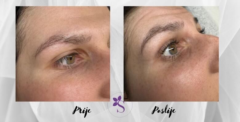 LASH ILI BROW LIFT uz uključeno bojanje i serum – osviježite svakodnevni izgled uz bezbolan i jednostavan tretman koji pruža WOW efekt u svakoj prilici