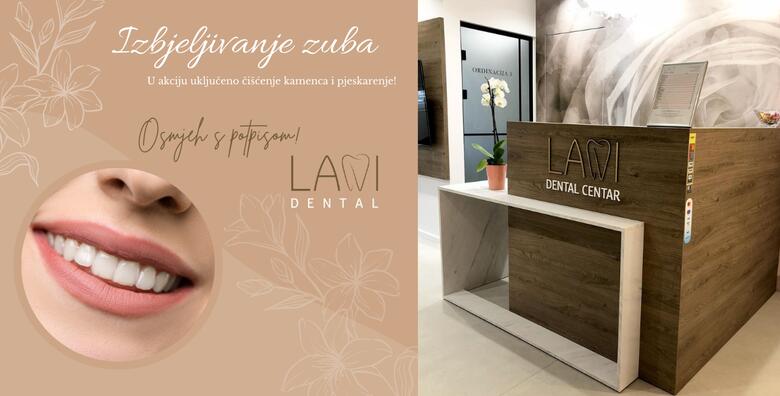 POPUST: 52% - Izbjeljivanje zuba uz čišćenje kamenca i pjeskarenje u LaNi Dental - neka Vam zdravi, bijeli i čisti zubi budu razlog porasta samopouzdanja! (LaNi Dental)