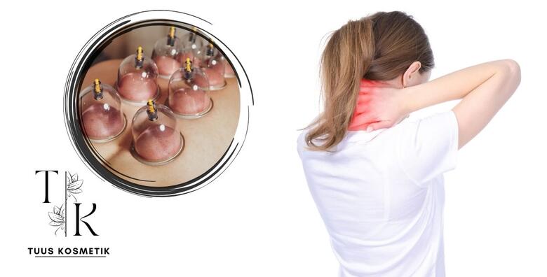 CUPPING MASAŽA – napravite detox ili tretirajte bolne mišiće, glavobolje i probleme s kralježnicom u Tuus Kosmetik