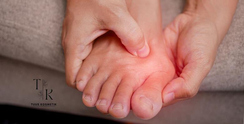 Tretman kurjeg oka – riješite se tvrdog i upaljenog zadebljanja na koži stopala već danas!