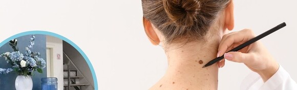 MADEŽI I BRADAVICE - otkrijte moguće zloćudne promjene i uklonite neželjene izrasline uz dermatoskopski pregled i lokalnu anesteziju u Poliklinici Superiora