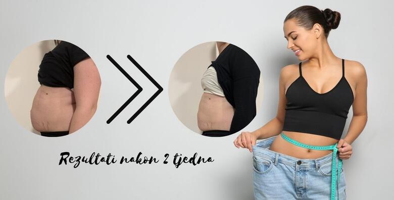 Dovedite figuru do savršenstva uz PAKET SCULPT koji uključuje 5 tesla Sculpt tretmana i GRATIS 2 limfne drenaže ili infracrvene saune