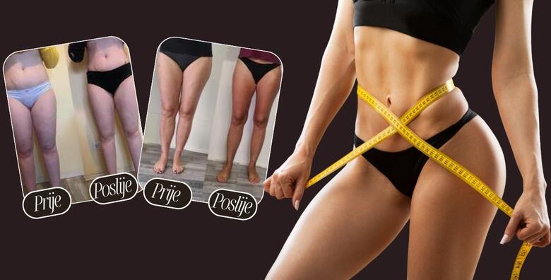 Oblikujte tijelo uz 5 tretmana aparativne limfne drenaže, 5 tretmana Vacuslim 48 i 5 tretmana elektrostimulacije mišića u Glam Lab-u