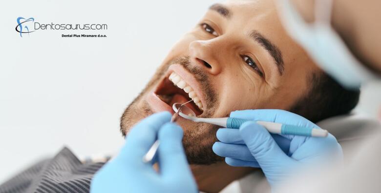 Jednoplošni kompozitni ispun - za osmijeh pun samopouzdanja uz pregled i savjetovanje u ordinaciji Dental Plus Miramare