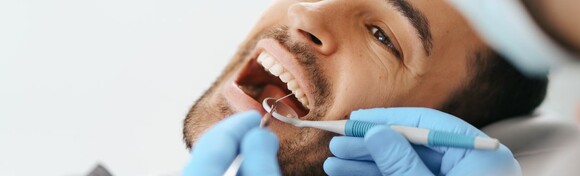 Jednoplošni kompozitni ispun - za osmijeh pun samopouzdanja uz pregled i savjetovanje u ordinaciji Dental Plus Miramare